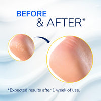 Dr. Scholl's Scholl Severe Cracked Heel Repair Restoring Balm, to repair Very Dry and Cracked Heels, Intensely Moisturising for Healthy Feet with 25% Urea, Epsom Salts and Essential Oils