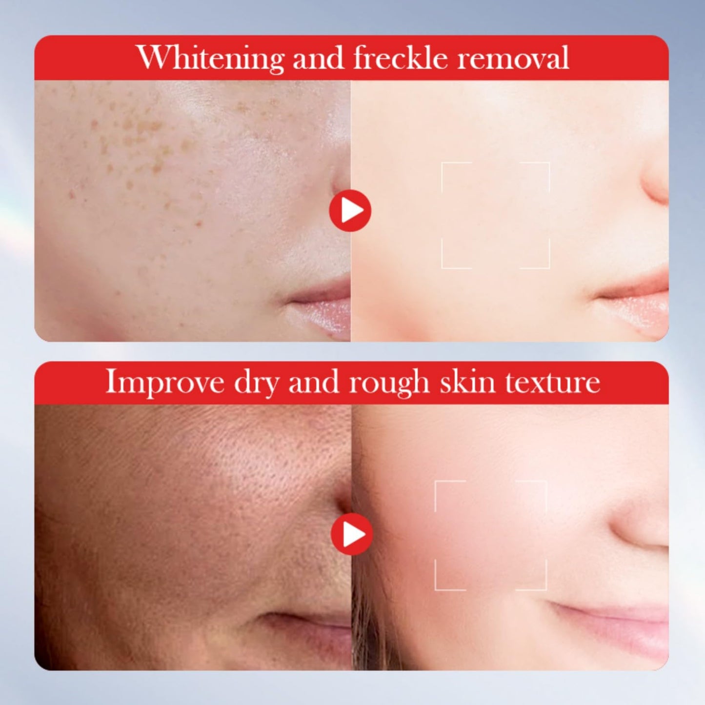 Bploar Kojic Acid Whitening Toner & Lotion, Kojic Acid Brightening Facial Toner & Lotion Set - Radiant Complexion & Moisture - For Even Skin Tone