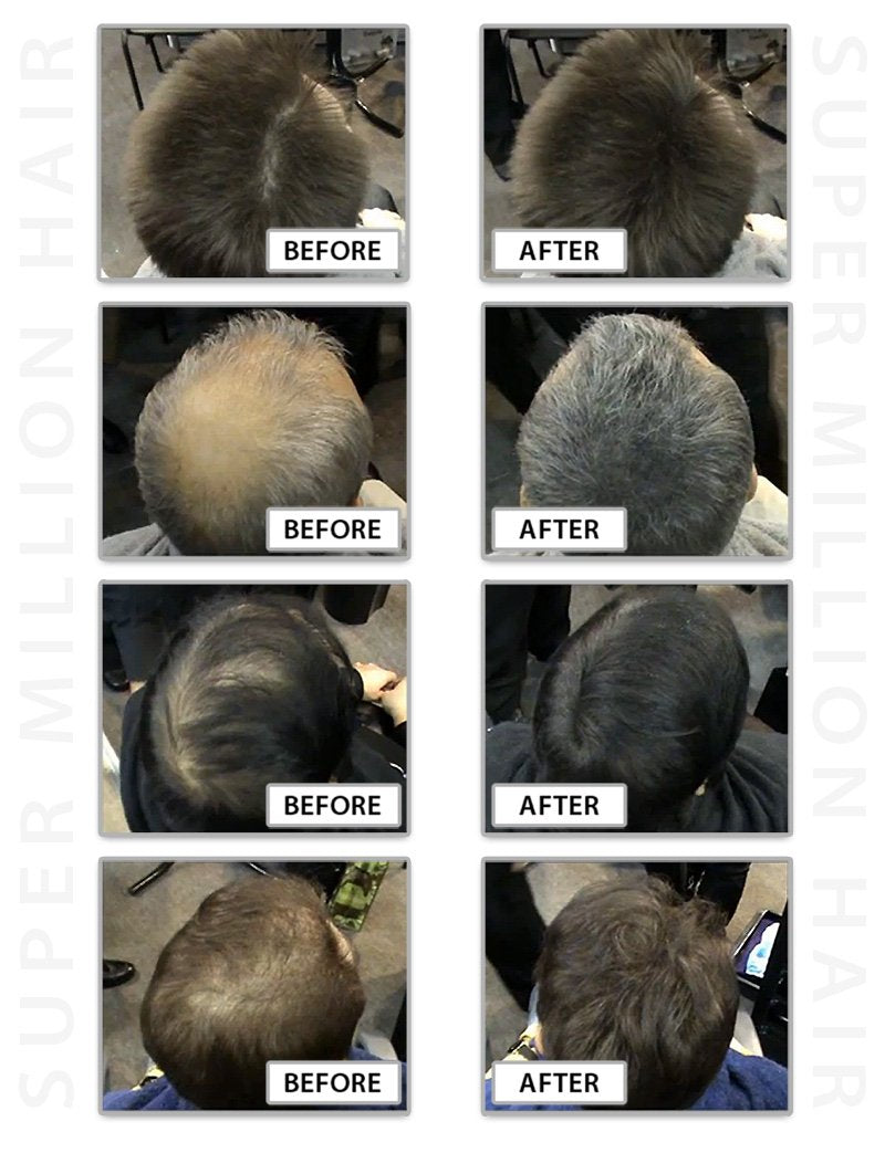 Super Million Hair 25g - No.23 Medium Brown by From the UK - Order by 2pm for next working day