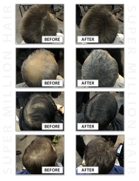 Super Million Hair 25g - No.23 Medium Brown by From the UK - Order by 2pm for next working day