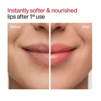 WishCare Tinted Ceramide Lip Balm with SPF50 PA+++ - Kojic Acid & Niacinamide - For Lip Lightening & Protection 5gm