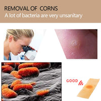 Cherioll Wart Remover, Corn Complete Removal, Corn Remover, Foot Corn Remover Pads, Plantar Wart Removal, Penetrates and Removes Common and Plantar Warts, Callus, Stops Wart Regrowth