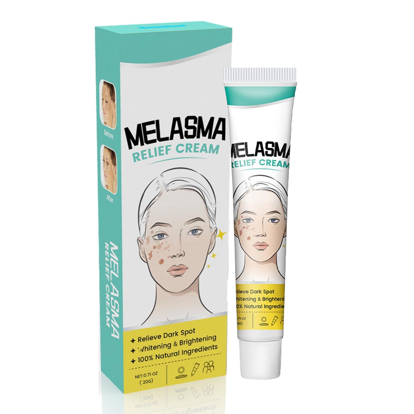 MEITREND Melasma Treatment For Face,Dark Spot Remover for Face & Body, Pigmentation Removal Cream,Corrector For Age Spots Sun Spots Freckles Melasma Brown Spots,Freckle Removal Cream