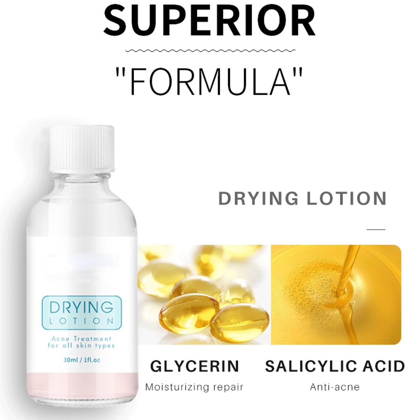 KAYZON Anti Acne Serum - Drying Lotion for Acne, Anti Acne Face Serum Dry Out Blemishes & Pimple Reduce Redness Acnecide Face Lotion for Teenage Girl Women Men Skin Care