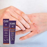 P'URE PAPAYACARE Natural Eczema Cream & Dry Skin Repair Ointment - P'URE PAPAYA CARE 25g OINTMENT Vegan Moisturiser with Shea Butter, Calendula, Jojoba Oil - Fragrance-Free, Hypoallergenic Therapy for Sensitive Skin