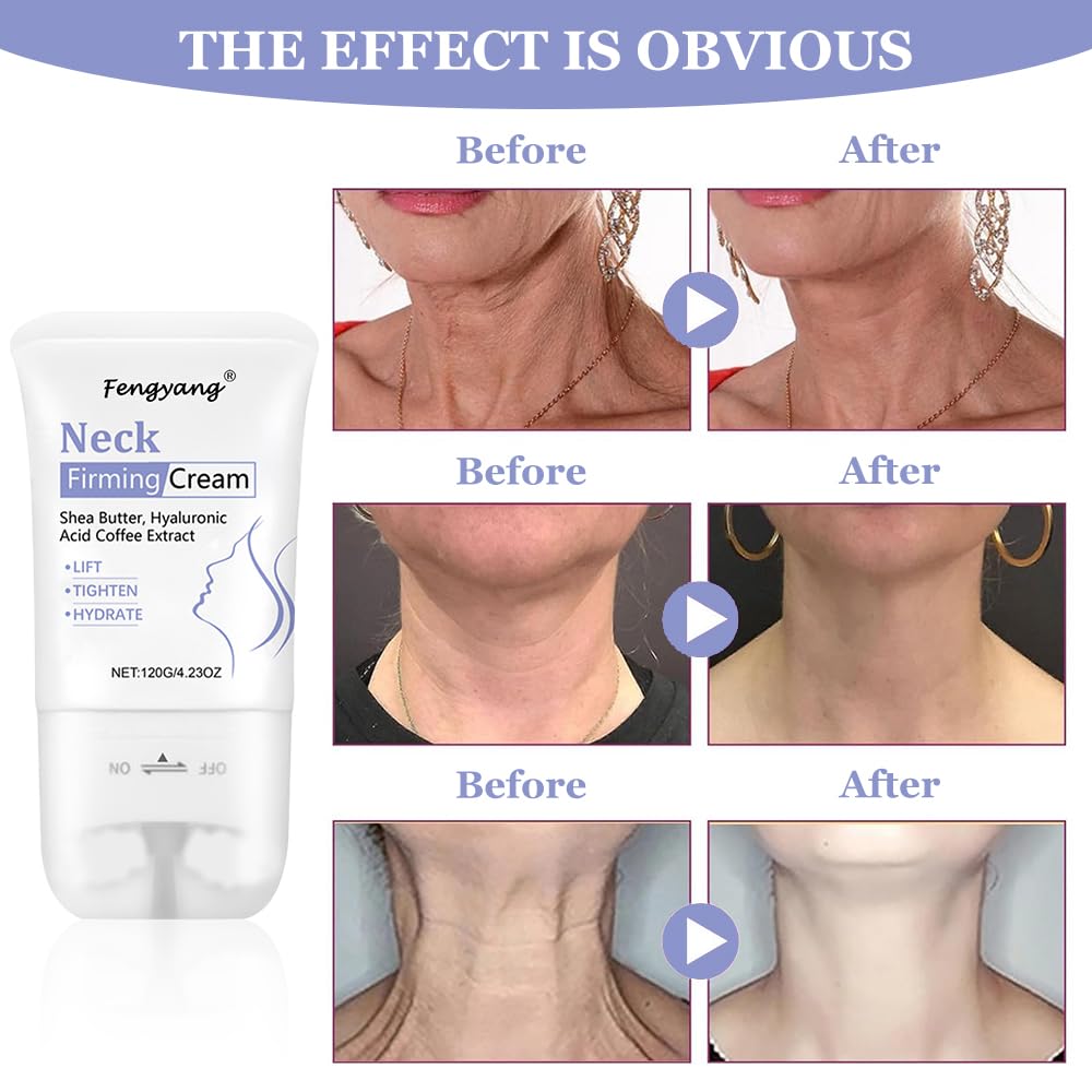 Fengyang® Neck Firming Cream,Neck Collagen Cream with Massage Roller – Tightens, Lifts & Smooths Wrinkles for Loose Skin – Anti-Aging Neck Cream for Women