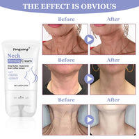 Fengyang® Neck Firming Cream,Neck Collagen Cream with Massage Roller – Tightens, Lifts & Smooths Wrinkles for Loose Skin – Anti-Aging Neck Cream for Women