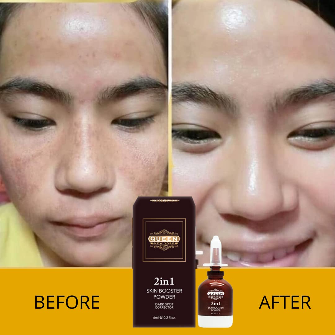 QUEEN NATURAL NEW YORK QUEEN 2in1 Skin Booster Powder-Naturally Radiant Skin, Soft and Smooth. Revealing Strong and Healthy Skin.