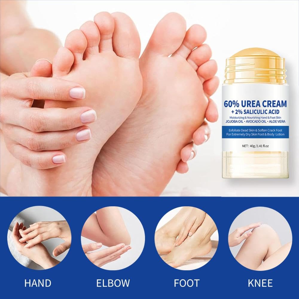 ZoeyShine 60% Urea Foot Cream for Cracked Heels and Dry Skin, Cracked Heel Cream, Skin Care Hands & Feet, Fast Absorbing Non-Greasy Formula with Moisturizing Ingredients