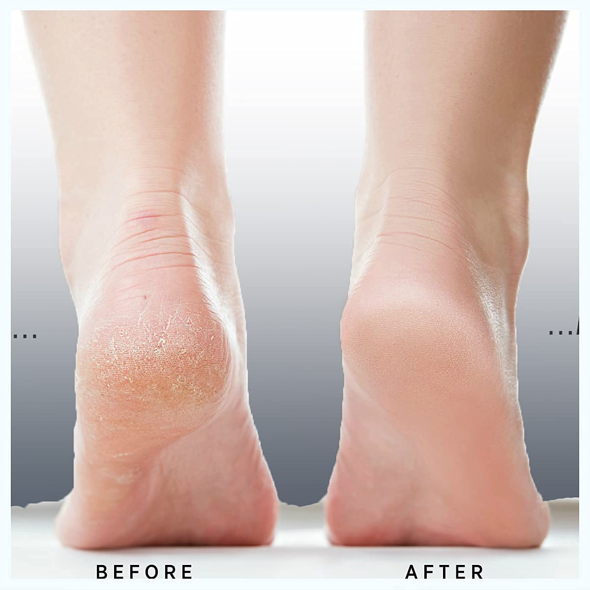 vanity uk Get Fresh- Rescue Me Lemongrass Intensive Foot Repair Cream Treats and Heals Dry Feet, Hard Skin Corns, Cracked Heels And Moisturize Feet