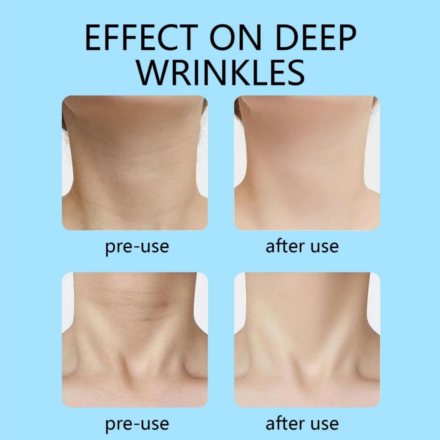 Yoowan 6pcs Firming Rejuvenating Neck Mask,Neck Tightening Products,Collagen Ne-Ck Mask,Dilute Skin Lines And Repair Skin,Moisturizing And Hydrating,Firming And Lifting,Soft And Breathable,Deep Nourishment