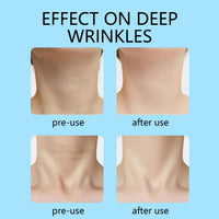 Yoowan 6pcs Firming Rejuvenating Neck Mask,Neck Tightening Products,Collagen Ne-Ck Mask,Dilute Skin Lines And Repair Skin,Moisturizing And Hydrating,Firming And Lifting,Soft And Breathable,Deep Nourishment