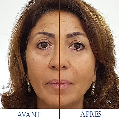 SKINEANCE - Magic Serum - Eye contour tensing effect - Smoothes fine lines and wrinkles - Reduces puffiness under the eyes - Acts in less than 3 minutes - Effective 8 to 10 hours - 5 tubes of 2 ml...