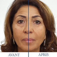 SKINEANCE - Magic Serum - Eye contour tensing effect - Smoothes fine lines and wrinkles - Reduces puffiness under the eyes - Acts in less than 3 minutes - Effective 8 to 10 hours - 5 tubes of 2 ml...