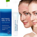 Retinol Gel,Retinol Gel for Face, Retinol Acne Treatment Gel & Skin Soothing Cream,Anti-Acne Moisturizer with Retinol, Spot Treatment for Acne-Prone Skin, Oil-Free,Non-Comedogenic