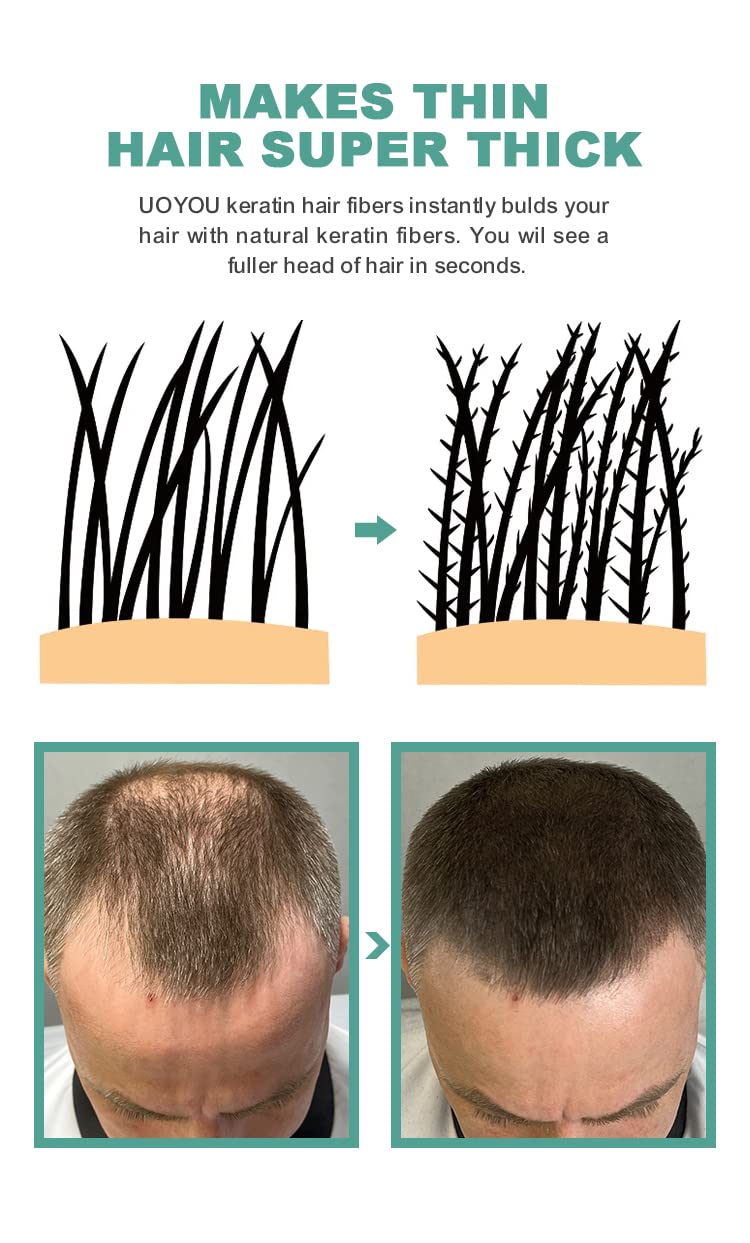 UOYOU DARK BROWN Hair Fibres for Thinning Hair 27.5g Bottle | Undetectable & Natural Keratin Hair Fibers Concealer for Hair Loss for Men and Women | Hair Building Fibres Powder [DARK BROWN]