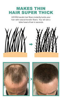 UOYOU LIGHT BROWN Hair Fibres for Thinning Hair 27.5g Bottle | Undetectable & Natural Keratin Hair Fibers Concealer for Hair Loss for Men and Women | Hair Building Fibres Powder [LIGHT BROWN]