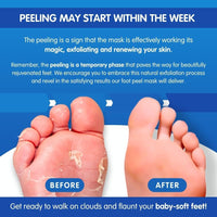Pedicure Grade Foot Masks That Remove Dead Skin | Smooth and Soften Foot Peel mask for Dry Cracked feet Premium | Callus Removal | Imperial Feet