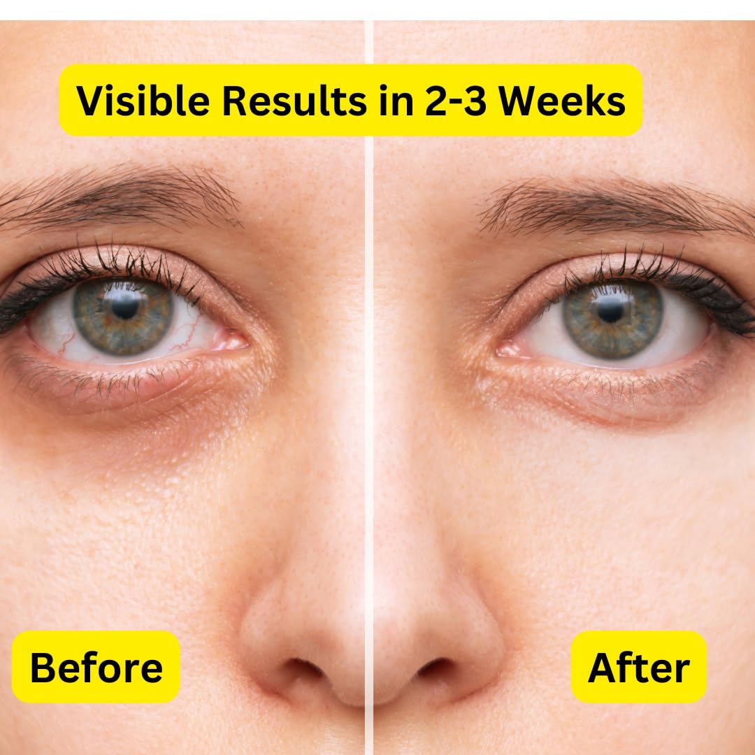 Prime9 Eye Cream for Dark Circles and Puffy Eyes| 60ml/2.02 oz Under Eye Cream for Women