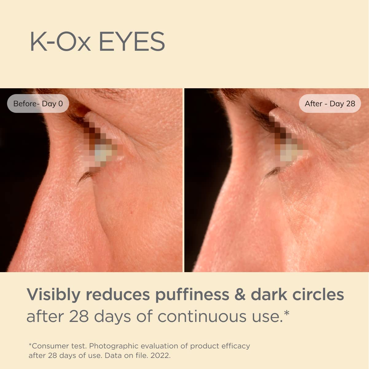 ISDIN Isdinceutics K-Ox Eyes | with Vitamin K Oxide | Reduces Puffiness & Dark circles (15 ml)