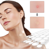 Udewo 252PCS Pimple Patches Acne Healing Patches Spot Treatment Sticker Absorbing Pimple Patches Translucent Hydrocolloid Patches Acne Stickers Invisible Spot Patches Blemish Stickers for Face and Body