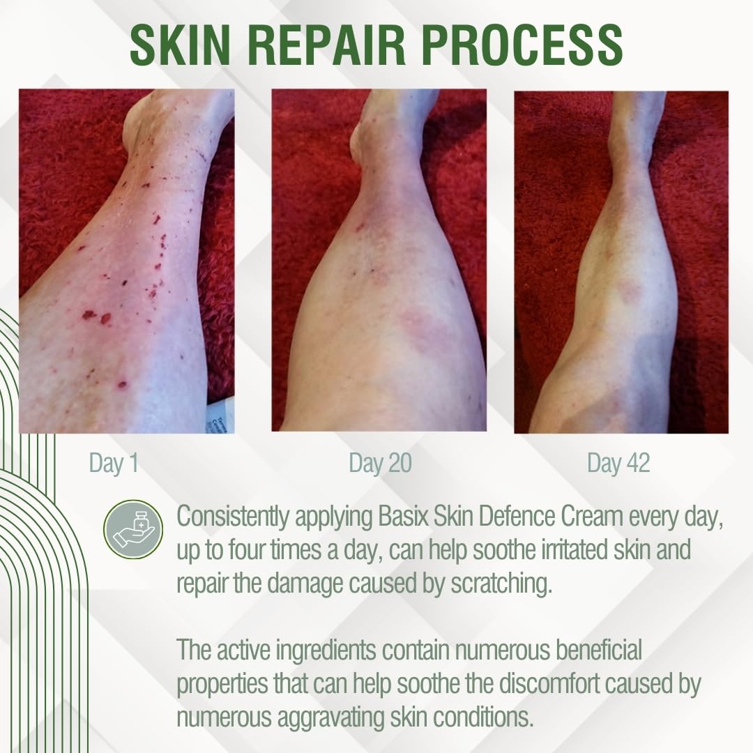 Basix Skin Defence Cream for Seriously Dry Skin with Kigelia Africana - 11 Natural Ingredients Repairs Eczema and Psoriasis Prone Skin - 50ml