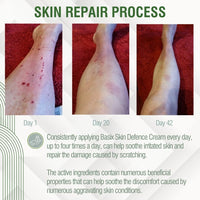 Basix Skin Defence Cream for Seriously Dry Skin with Kigelia Africana - 11 Natural Ingredients Repairs Eczema and Psoriasis Prone Skin - 50ml