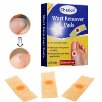 Cherioll Wart Remover, Corn Complete Removal, Corn Remover, Foot Corn Remover Pads, Plantar Wart Removal, Penetrates and Removes Common and Plantar Warts, Callus, Stops Wart Regrowth