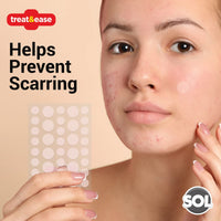 36pk Spot & Cold Sore Patches | 12pcs 8mm & 24pcs 12mm Skin Care Pimple Patches | Acne Patch Hydrocolloid Patches | Face Care Spot Patches | Pimple Patch Acne Patches Hydrocolloid Patch + SOL Sticker