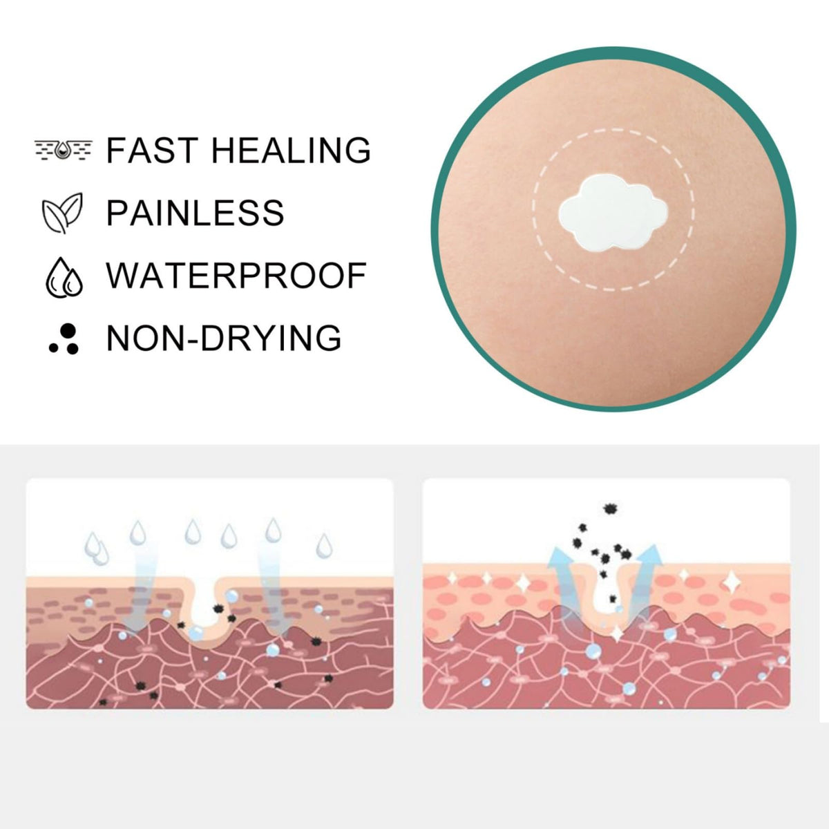 QinZiEn Acid Spot Cream,Acne Treatment for Spot Prone Skin,Acne Scar Treatment,24-Hour Spot Reduction,Acne Cream,Dark Spot Remover for Face,A/nce Scar Removal C/ream,Spot Treat/ment,15g