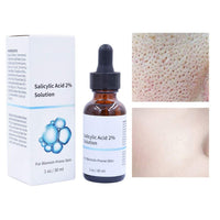 Salicylic Acid Concentrate Super Strong 2% - Acne Spot Treatment - Professional Skincare Serum