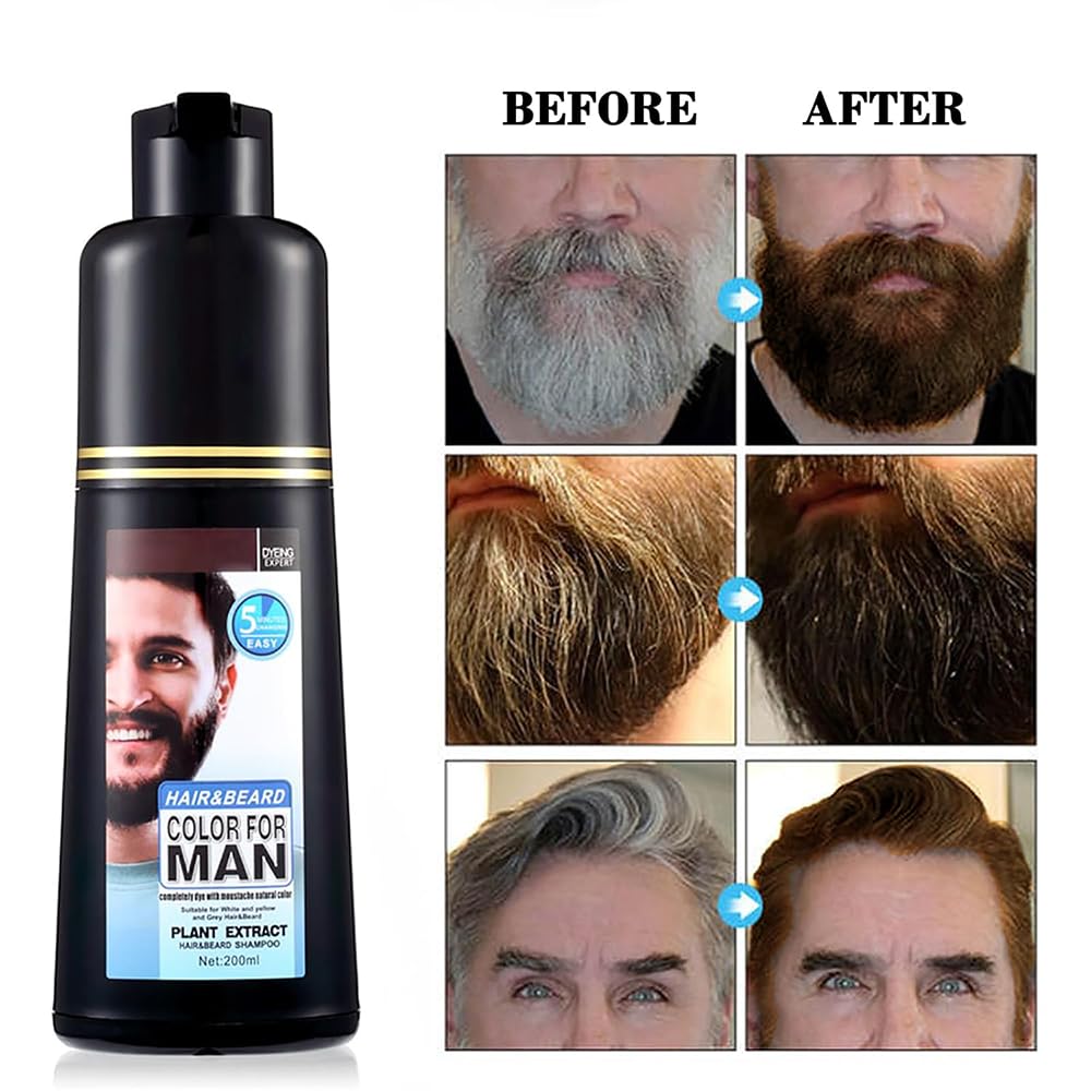 JRTTOSSE Men's beard and moustache hair dye for grey hair to dark brown, men's moustache hair dye, dark brown in 5 minutes, easy to use, dark brown moustache hair dye and hair colour shampoo, 200 ml.