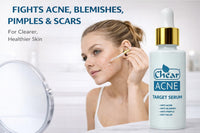 CHEAR ACNE Chear Acne Target Serum 60ml – Salicylic Acid BHA Spot Treatment with Witch Hazel & Neem, Pore Clearing Serum for Acne, Oily Skin & Blackheads