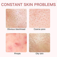 ISBEAUSOLS 2pcs Acne Tratment Face Gel 15% Acid - Spot Treatment For Face - Acne Treatment for Spot Prone Skin - Spot Gel for Women,Men,Teenager - Clean Skin,Pimple Reduce,Blackhead Remover