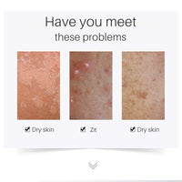 AuraAnge Zit - Targeting Serum - Face Serum for Blemish - Prone Skin, Helps Absorb Excess Oil, Suitable for Men and Women