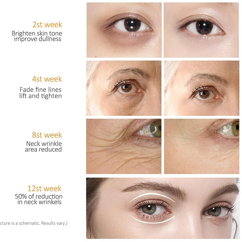 Retinol Eye Cream-Eye Cream For Dark Circles And Puffy Eyes,Anti-Aging Eye Cream With Retinol Serum,Hyaluronic Acid,Retinol Serum-Anti Wrinkle Eye Cream-Moisturising Eye Bags Remover