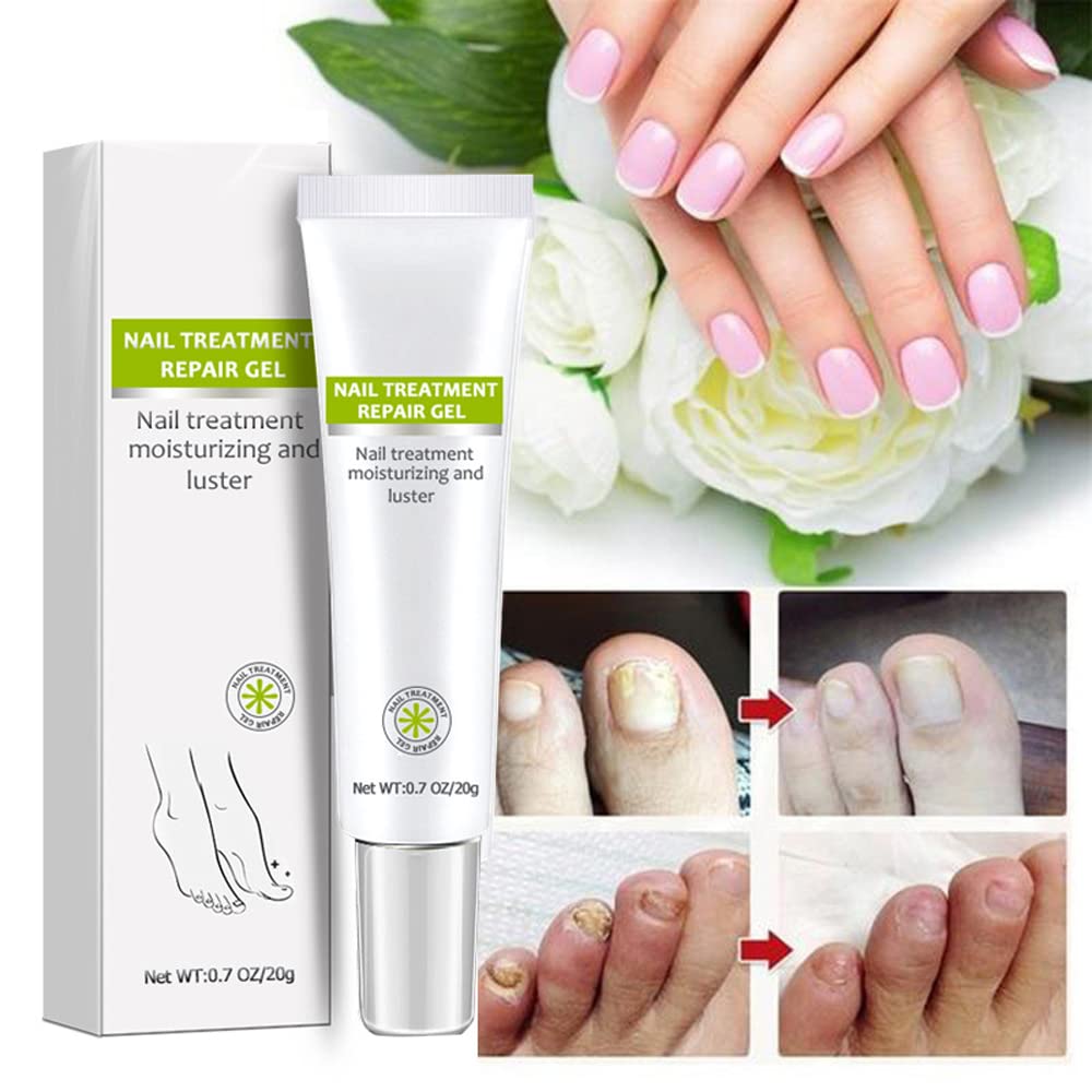 Nail Repair - Nail Treatment Repair Gel/Nail & Toenail Treatment Nail Repair Cream/Toe Be Health Instant Beauty Cream, Renews Yellow, Cracked, Damaged and Split Nails
