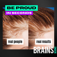 Brains & Son Hair Fiber - Premium Hair Thickener – Immediately Conceals Receding Hairlines, Hair Loss, Balding Areas and Thinning Hair – Undetectable Keratin Fibers - Hair Powder | 25g (LIGHT BLONDE)