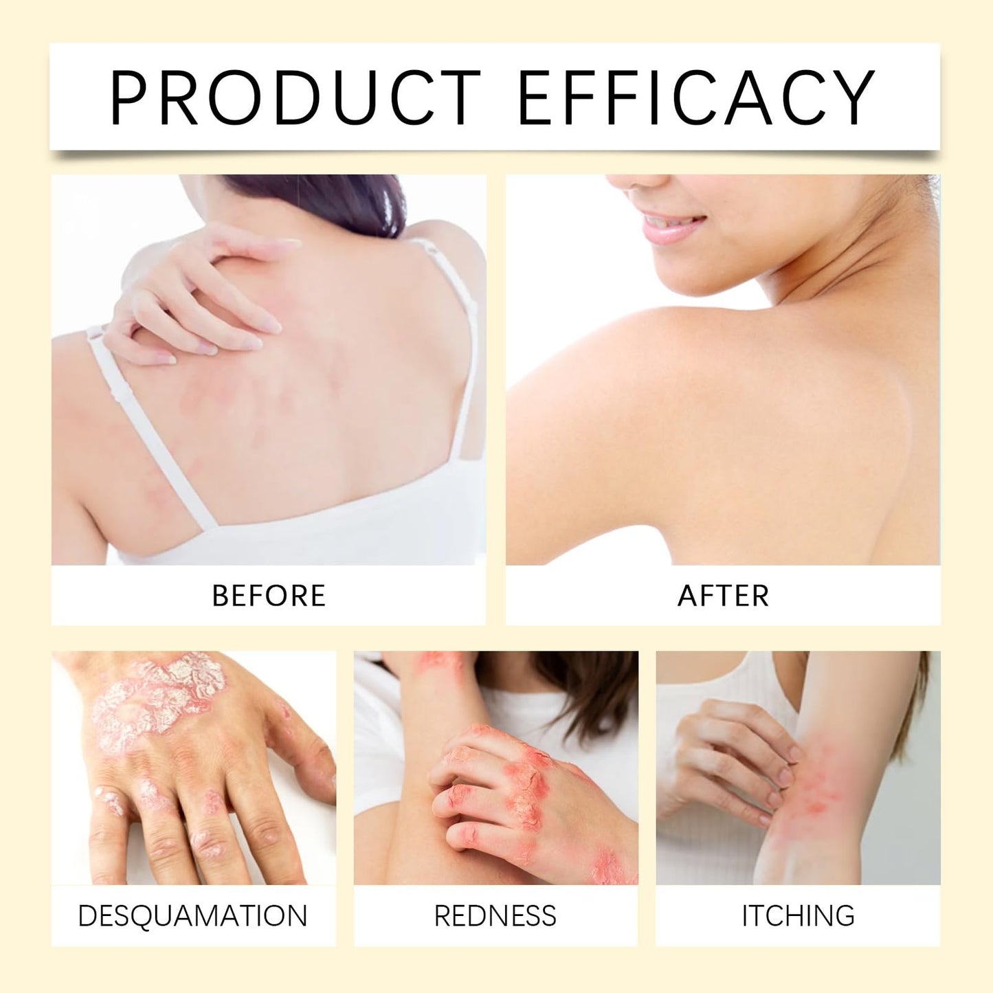 Mubuni 2PCS Bee V/enom Wrinkle Removal Cream,Bee V/enom Cream for All Skin Types,Be/e Ve/nom Crea/ms for Skin,B/ee Veno/m Comprehensive Cre/am,Be/e Ven/om Skin Treatment Cr/eam,B/ee Ve/nom Face C/ream