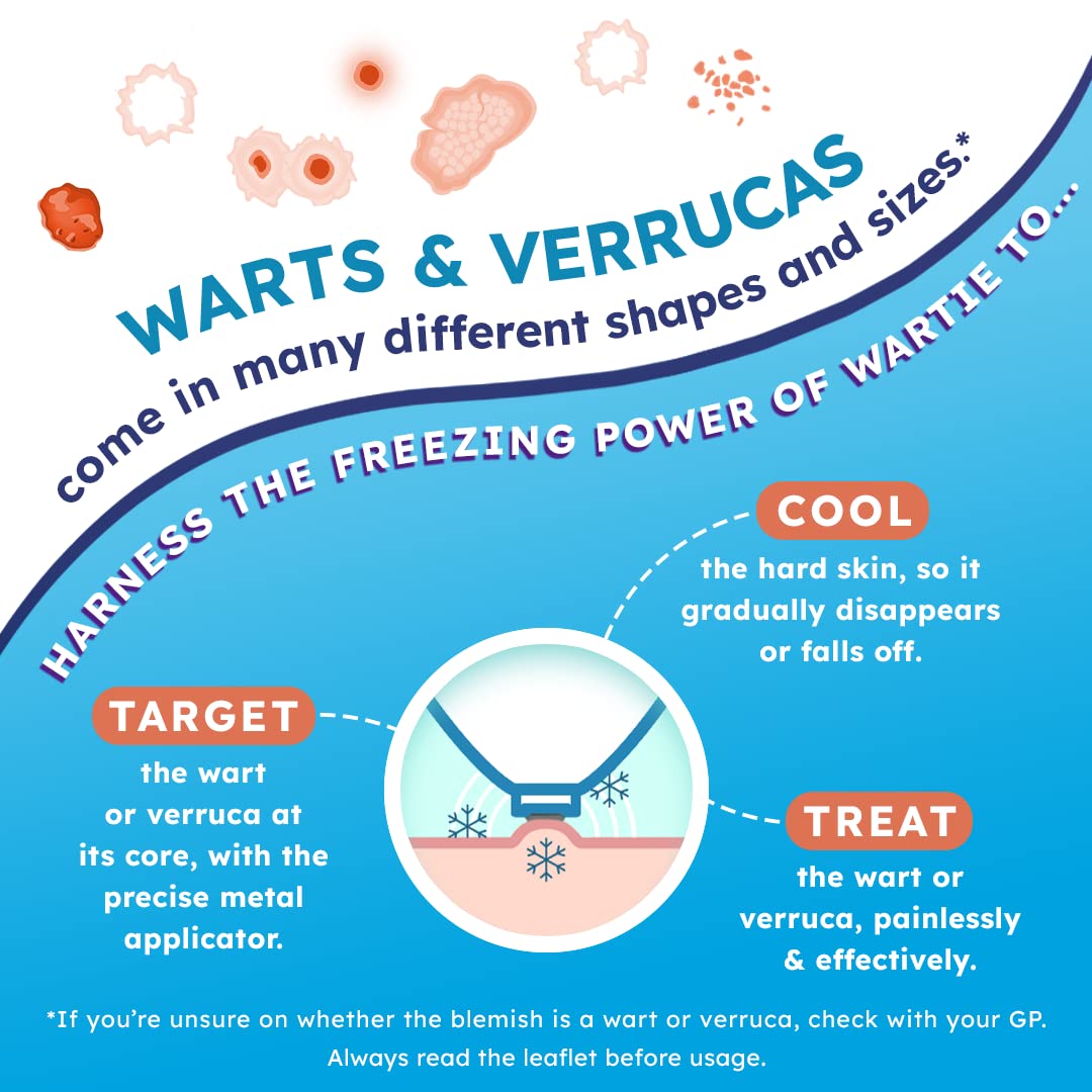 Wartie Freeze Wart and Verruca Remover, Safe For Adults and Children Aged 4+, Fast Acting Wart and Verruca Treatment For Hands and Feet, Contains 15 Applications, White, 50 ml (Pack of 1)