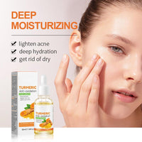 ZQUKAMZ Turmeric Anti-oxidation Serum, Turmeric Anti Oxidation Face Serum, Turmeric Oil for Dark Spots, Turmeric Dark Spot Removal Correction Essence and Turmeric Moisturizing Facial Essence 30ML
