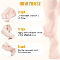 Trendyfave 60% Urea Cream For Cracked Heels - Urea Foot Cream - Foot Cream for Cracked Heels and Dry Skin - Cracked Heel Repair Cream - Skin Care Hands & Feet - Intense Moisturiser with Jojoba Oil & Aloe Vera