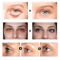 Nuonove Under Eye Mask, Collagen Eye Mask, Under Eye Patches, Eye Pads, Anti Aging Eye Patches with Collagen, For Brightens & Reducing Wrinkles, Dark Circles, Eye Bags and Puffiness/30 Pairs