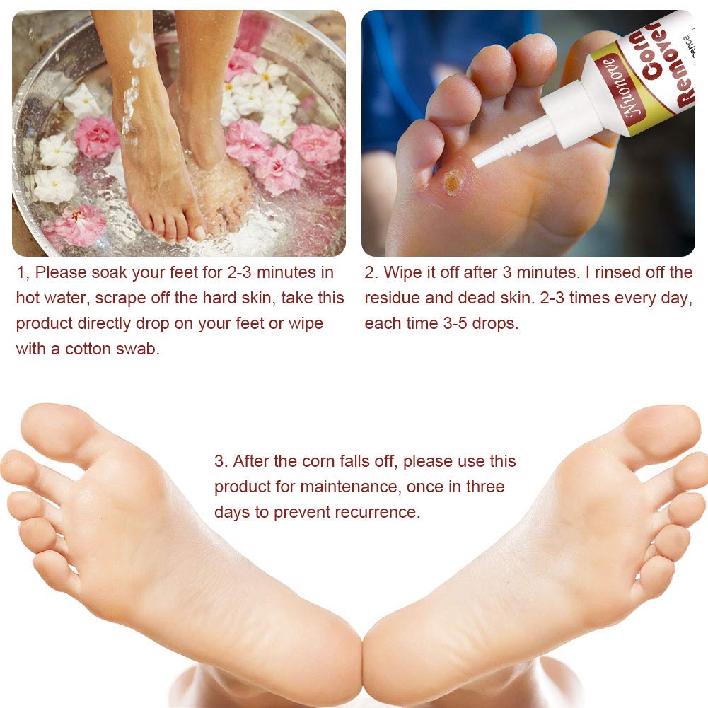 Corn Remover Wart Remover Corn Removal Corn Remover for Feet, Callus Remover, Cuticle Remover, Corn Remover Liquid to against Corn & Wart,15ml