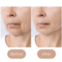 Zentri Ponds Triple Action Day Cream 3A Face Moisturiser Day Cream & Night Cream - Anti Wrinkle | Anti Sagging | Blemish Control | Anti Ageing Face Cream With Vitamins A & E - 50ml x 3