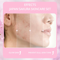 HUAIAN Sakura Skin Care Sets & Kits,Girls Pamper Set, Face Care Sets For Women,Cherry Blossom Skincare Teenage Girls Gifts - Cleanser,Toner,Serum,Eye,Essence Cream - Japanese Skincare
