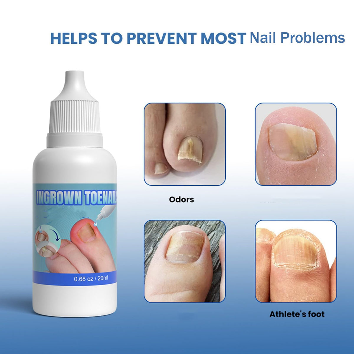 ASMAYSA Ingrown Toenail Correction Extra Strong - Ingrown Toenail Drop- Cuticle Care Oil for Ingrown Toenails - Trimming Toenail Softening Drop Ingrown Toenail Correction,20ml