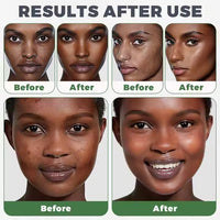 100% Natural African Black Soap | Skin Brightening & Black Spot Removal Unprocessed, Handmade, | Anti-Ageing, Acne Care, Deep Hydration & Moisturizer | Ethically Sourced for All Skin Types