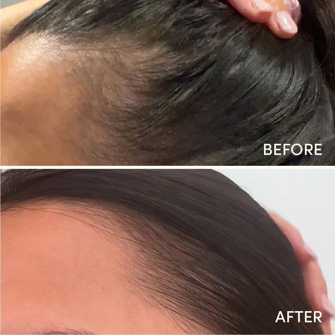 Glow for it Glow For It - Hair Growth Serum 50ml | Promotes Fuller and Thicker Growth | For Thinning, Weak Hair Or Slow Growth | Water Based Serum | Nourishes Scalp Without Greasy Residue