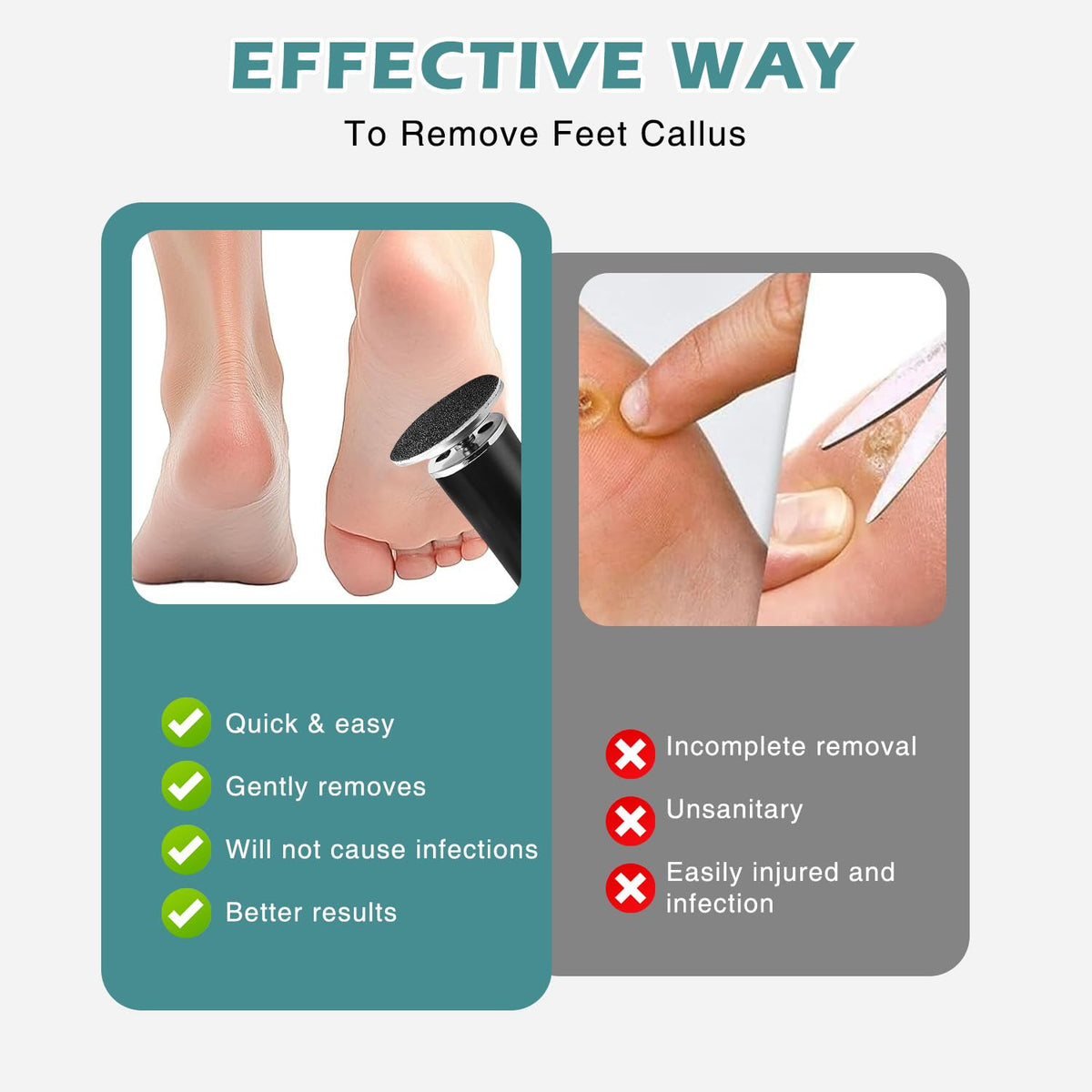 atnayo Electric Foot File Hard Skin Remover, Clean Brush and Foot Sander for Hard Skin Callus Dry
